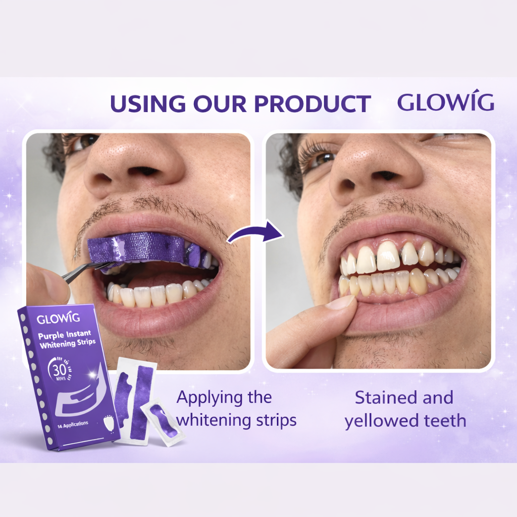 GLOWIG - Whiter Teeth In 30 Minutes