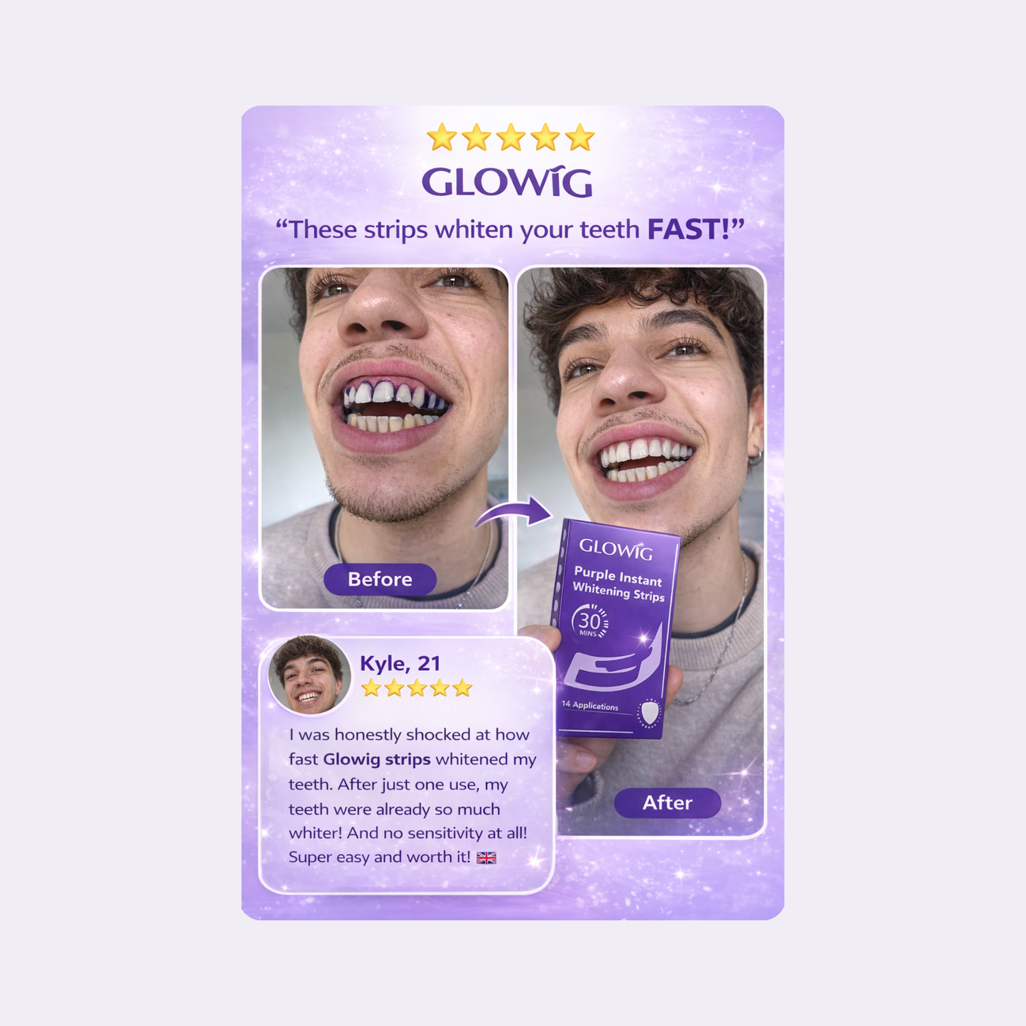 GLOWIG - Whiter Teeth In 30 Minutes